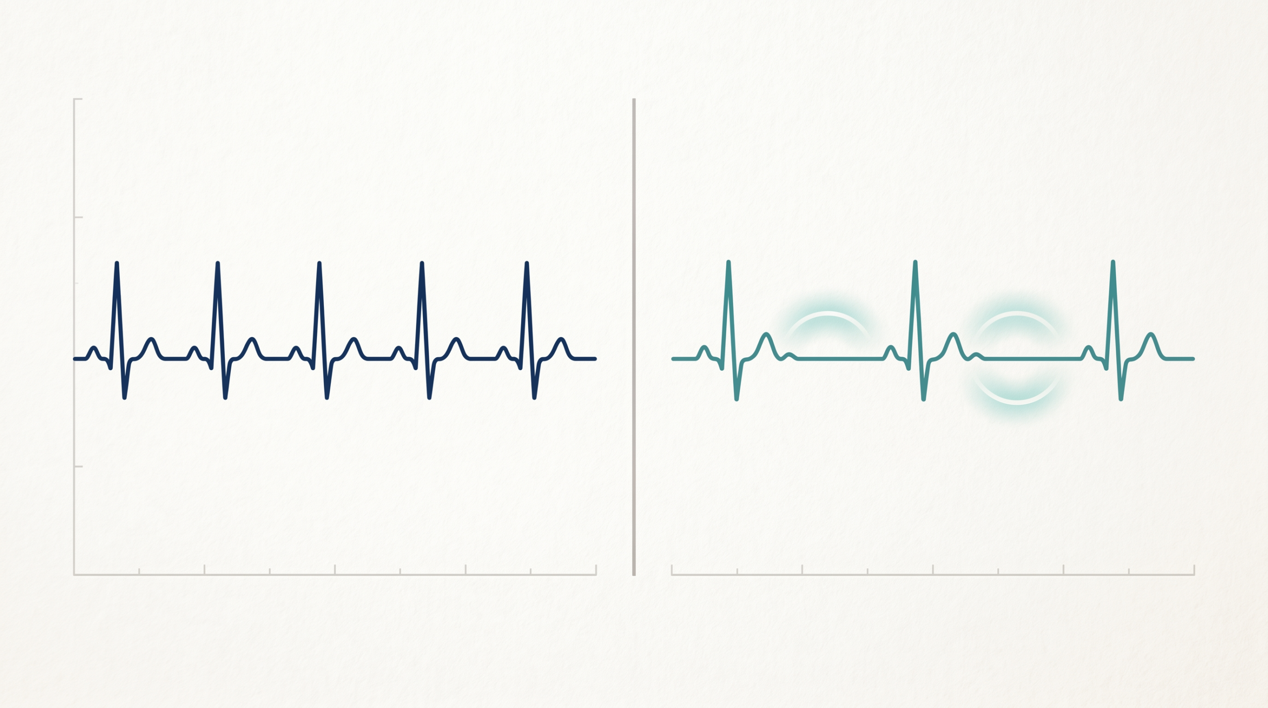Illustrative comparison graphic showing what resting heart rate and heart rate variability each measure
